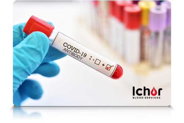COVID 19 Antibody Testing