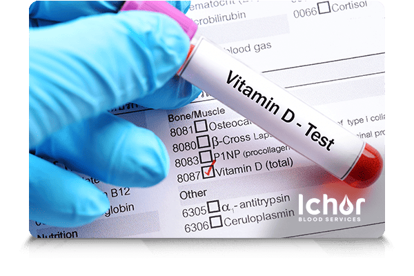 Mayo Clinic Vitamin D Test