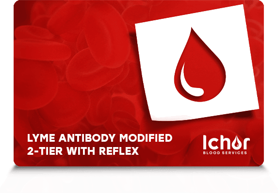 Lyme Antibody Modified 2-Tier with Reflex